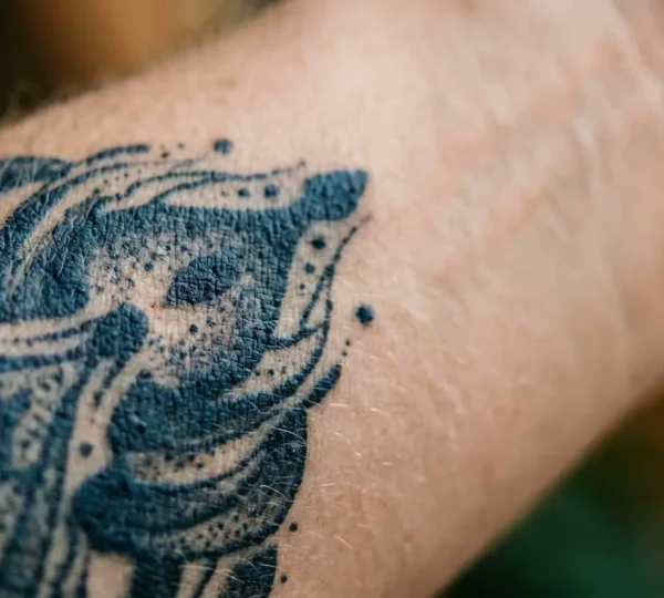 Gros plan artistique sur une zone de peau tatouée en cours de traitement laser de détatouage, avec mise au point sélective sur la texture cutanée