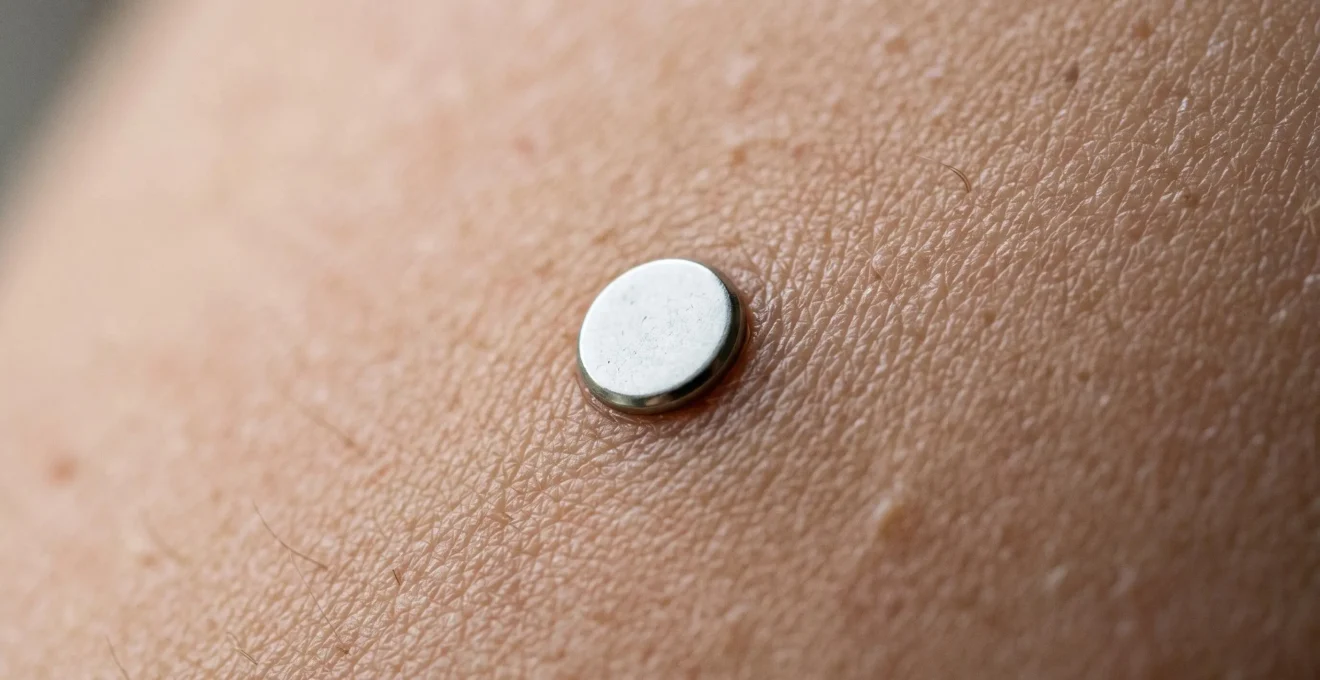 Gros plan d'un implant microdermal dermique sur la peau avec éclairage naturel