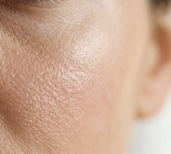 Gros plan sur une peau de visage montrant la texture et l'hydratation naturelle, sans maquillage ni texte visible