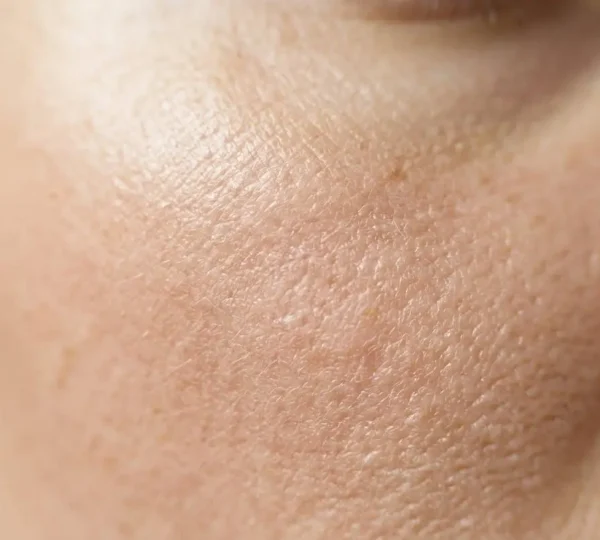 Gros plan sur une peau humaine saine avec texture naturelle visible montrant les pores dans une lumière douce et naturelle