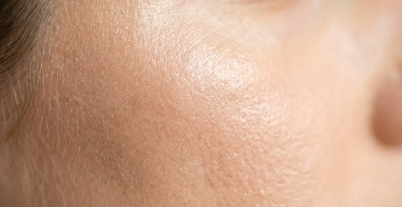 Vue macro de la peau en cours de renouvellement après un peeling chimique