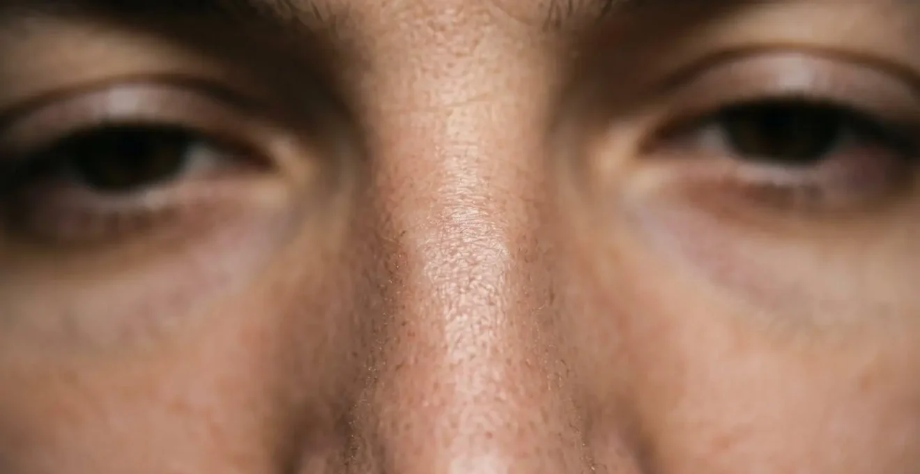 Gros plan sur l'arête nasale entre les yeux montrant l'anatomie du bridge en lumière naturelle