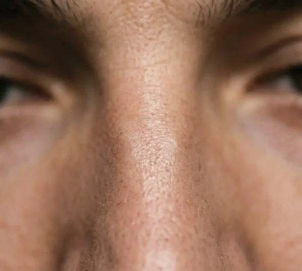 Gros plan sur l'arête nasale entre les yeux montrant l'anatomie du bridge en lumière naturelle