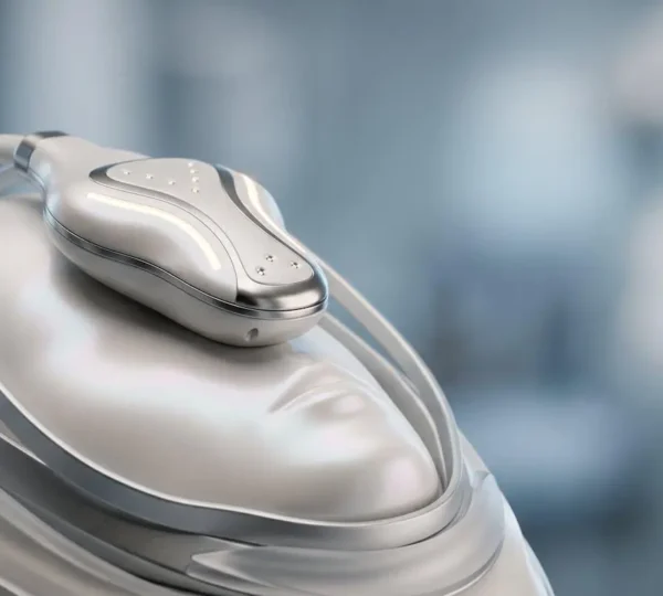 Représentation artistique d'une technologie médicale esthétique moderne pour le rajeunissement du visage sans chirurgie