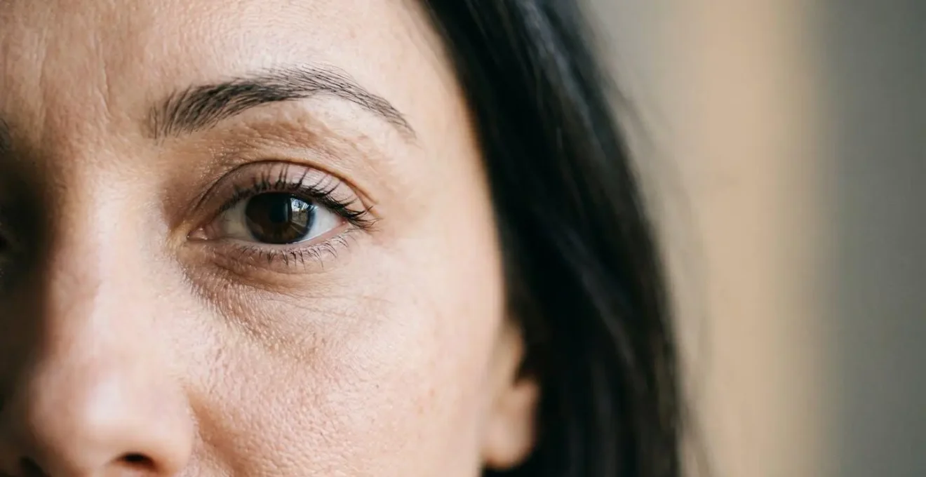 Gros plan sur le contour des yeux d'une personne montrant la zone sous-orbitaire pour illustrer le traitement des cernes creux