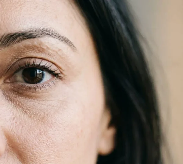 Gros plan sur le contour des yeux d'une personne montrant la zone sous-orbitaire pour illustrer le traitement des cernes creux
